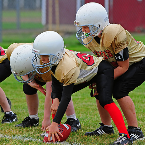 mouthguards